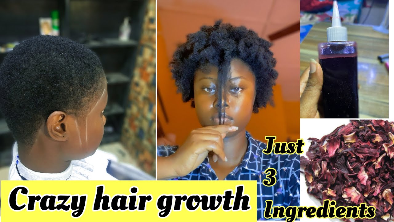 this-product-will-make-your-hair-grow-like-crazy-zobo-leaves-for