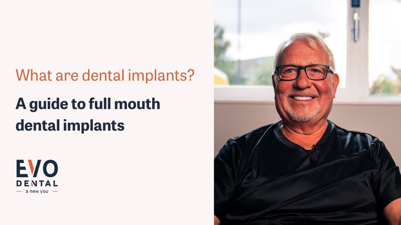 What Are Dental Implants? A Guide To Full Mouth Dental Implants | EvoDental