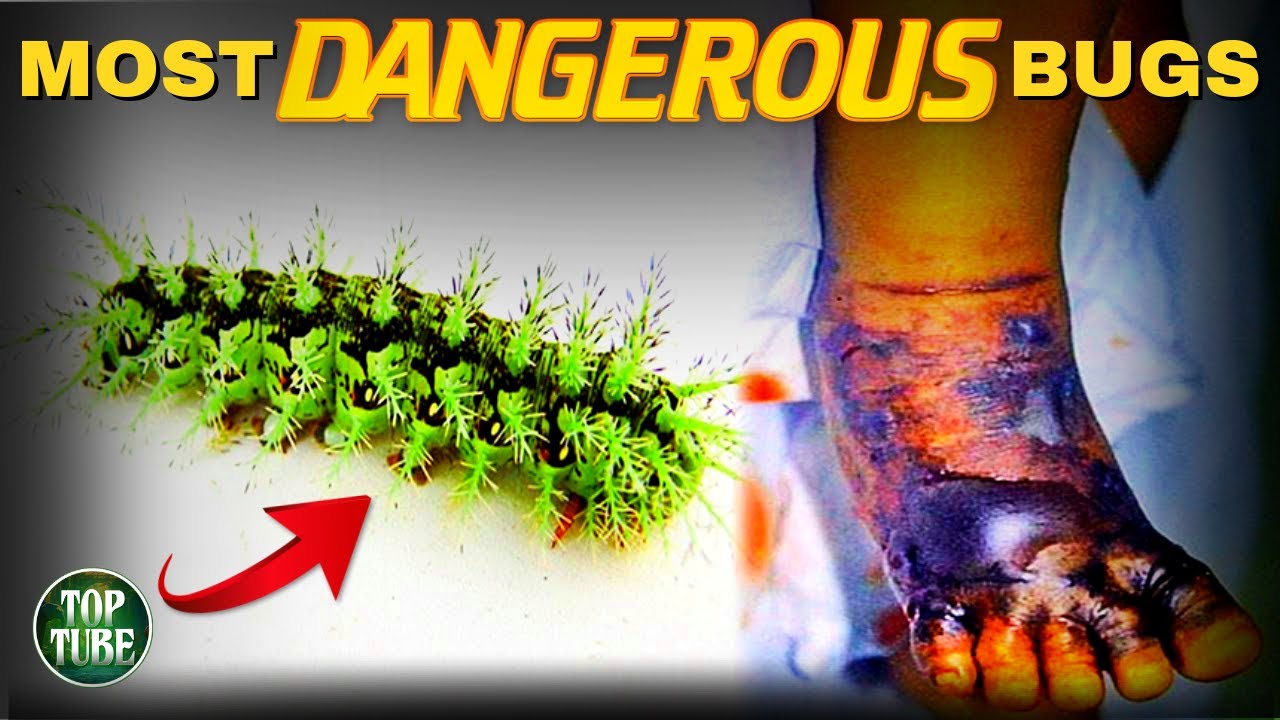 10 Most Dangerous Bugs in the World - YouTube