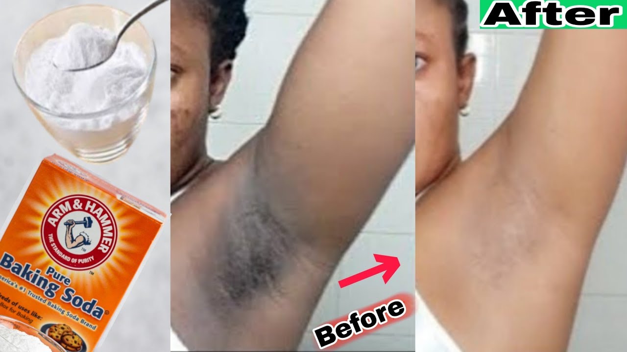 lighten-dark-armpits-faster-get-rid-of-odour-how-to-lighten-dark-armpit