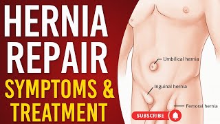 Surgeon Reveals TOP Hernia Repair Options for FAST Relief