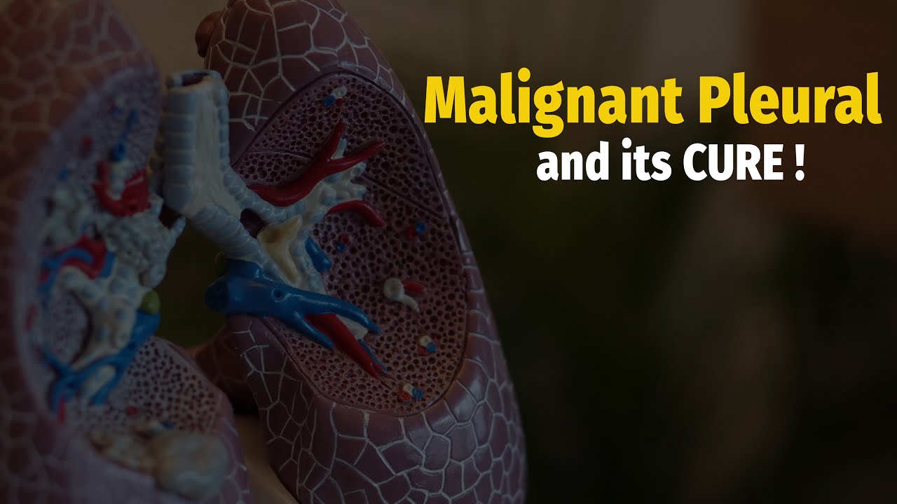 What is Malignant Pleural and its cure ? YouTube