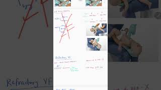AHA BLS ACLS UPDATE 2025 #acls #aha #update #criticalcare