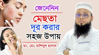 মেছতা দূর করার সহজ উপায় | DR.MD. Rashidul Hasan | Melasma Treatment Bangla Tips | Doctor Tube screenshot 1
