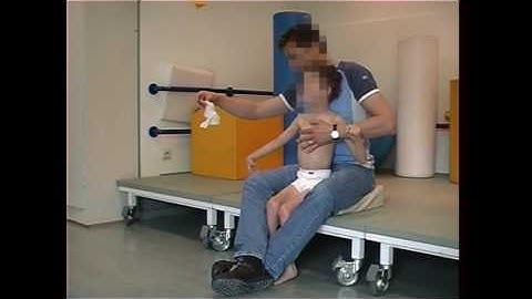 Dyskinetic cerebral palsy, case 2