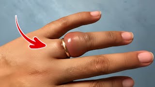 Download Lagu JUTAAN ORANG BELUM TAHU‼️Cara mudah melepas Cincin yang Macet MP3