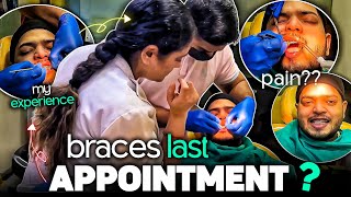 Braces Ki Last Appointment आ गयी 😍| Braces Update | #braces #bracestreatment