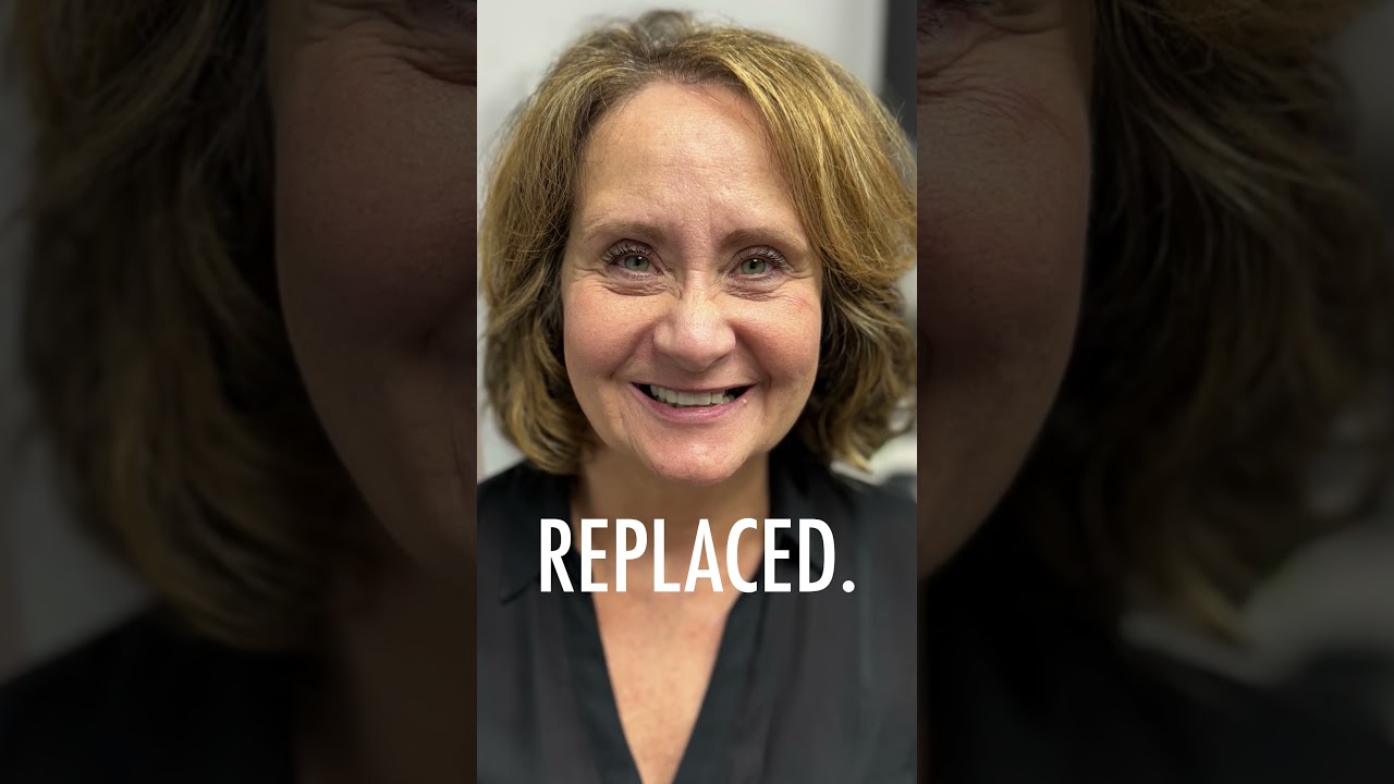 From Failing Teeth to a Life-Changing Smile | 3-on-6 Transformation with Dr. Alex Shore in Chicago