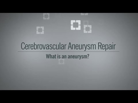What Is a Brain Aneurysm?
