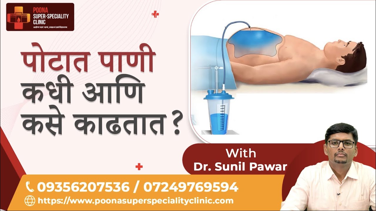 पोटातील पाणी कसं आणि कधी काढतात?|Dr. Sunil Pawar| 