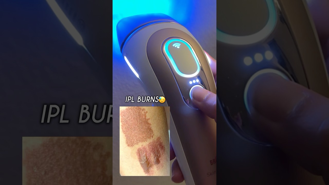 Tried Braun IPL at home, that’s what I have to say 