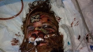 California Cops Acquitted In Murder Of Kelly Thomas - Policebrutality.us