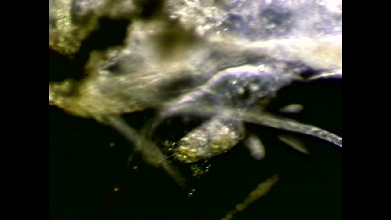 Stylonychia sp. under microscope