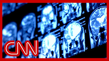 How the technology behind ChatGPT could make mind-reading a reality