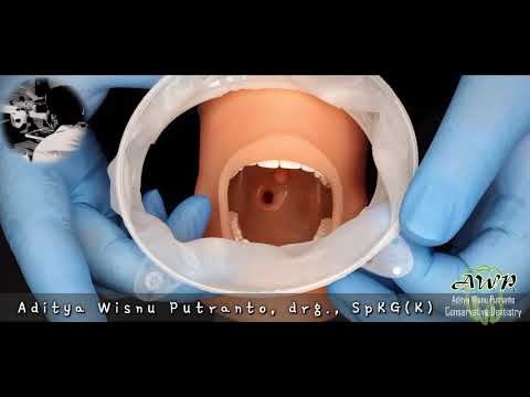 Video: Pemasangan Pelindung Mulut Di Kedokteran Gigi PROPRICUS