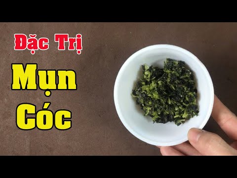 Trị mụn thịt mụn cóc quanh mắt nhanh chóng chỉ 5 phút với nguyên liệu tự nhiên_Mẹo chữa bệnh