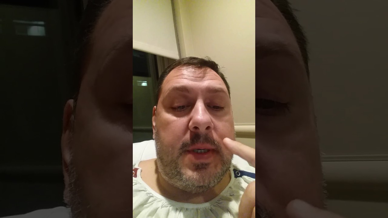 VSG surgery a man's perspective part 2