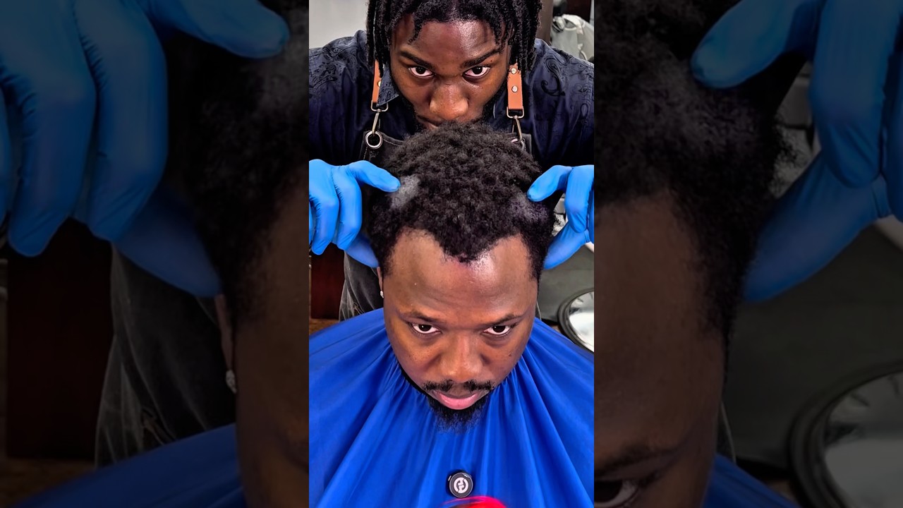 Его линия роста волос сбила его с толку, и он захотел лысую голову 🤯 