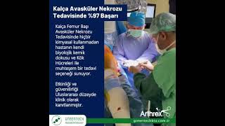 Arthrex Intraosseous Bioplasty Iobpkalça Femur Başı Avasküler Nekrozu Tedavisinde Devrim