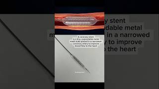 The Tiny Stent That Keeps You Alive #biology #stent #shorts