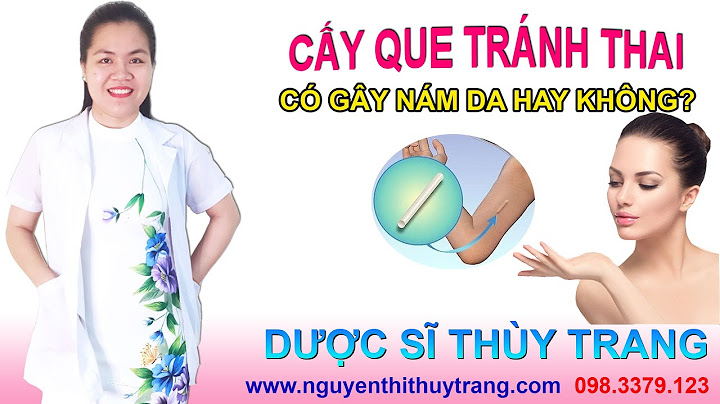 Cấy thuốc tránh thai giá bao nhiêu