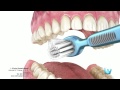 Higiene dental - Clinica identis