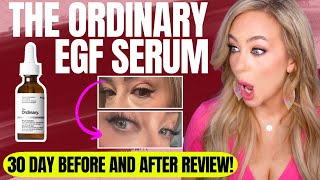 The Ordinary EGF Serum 30-Day Review — This $15 Serum Beat My $160 Favorite