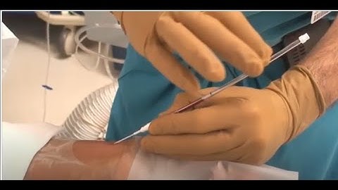 Paul G. Barash explains Arterial Line Insertion