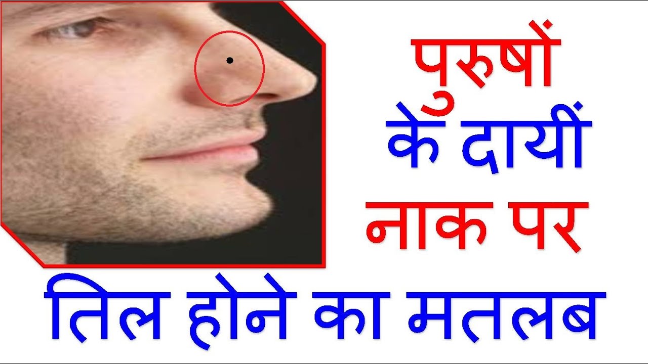 naak-par-til-ka-matlab