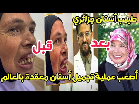 طبيب أسنان جزائري يعيد الابتسامة في أصعب عملية تجميل أسنان معقدة بالعالم 
