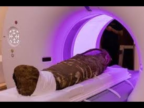 When Scientists Examined This Ancient Child Mummy, They Discovered A Strange Object In Its Entrails