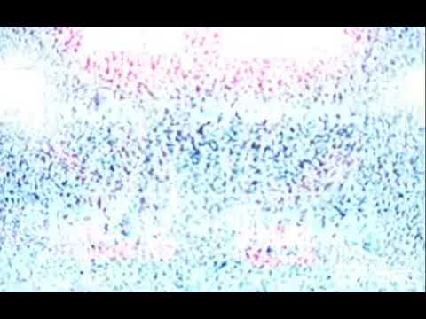 Tamer Hosny FT Cheb Khaled Wa Enta Maayia Remix Abdelfattah Grini Ft Balti