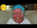 Life as a Teen with Harlequin Ichthyosis (School, Boys, Drama and a Rare Skin Disorder)