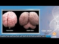 تعرف على أجزاء مخ الإنسان ووظيفة كل منها مع الدكتور حمزة زوبع
