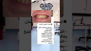 اسباب إصفرار الاسنان ..