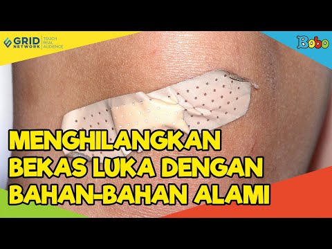 Fakta Menarik - Cara Menghilangkan Bekas Luka dengan 4 Bahan Alami