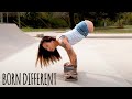 Born Without Legs - But I Can Still Do Anything | BORN DIFFERENT