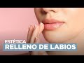 Relleno de labios con ácido hialurónico