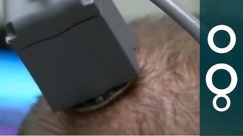 Neurobridge Turns Thoughts Into Movements - Science