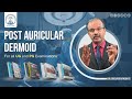Post Auricular Dermoid by Dr. SRB | Dr. Srirama Bhat