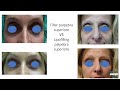 Nuove frontiere in medicina estetica