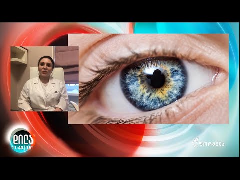 რეკომენდაციები - მხედველობის ვარჯიშები