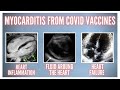 13 Year Old Boy Dies 3 Days After COVID Vaccine | Vaccine Side Effect