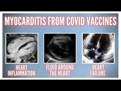 13-jarige jongen sterft 3 dagen na COVID-| Bijwerking vaccin