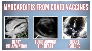 وفاة صبي يبلغ من العمر 13 عامًا بعد 3 أيام من لقاح COVID | الوفيات بعد اللقاح