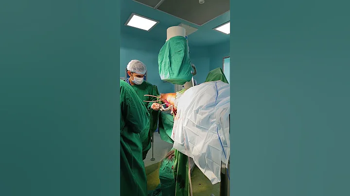 #PFN Proximal Femoral Nail | #ortho_surgery