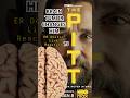 Brain TUMOR Changes The Personality | THE PITT Season 2 | Part 75 #thepitt #shortsfeed #shorts #fyp