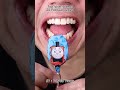 Satisfying Chewing ASMR #Compilation #ASMR #DoctorTristanPeh