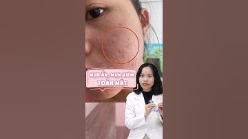 Tư vấn phác đồ mụn ẩn, mụn viêm thâm đỏ nhẹ nhé! #mun #munan #viem #thamdo #bshangtran