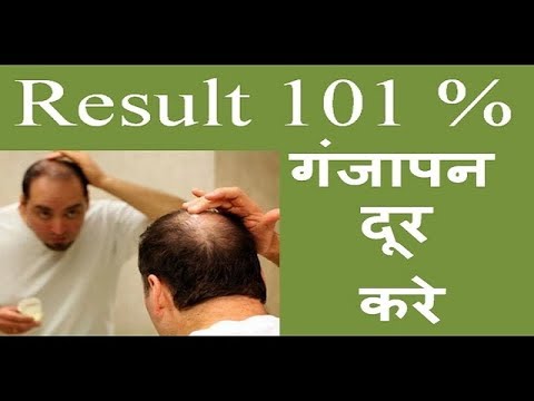 hair problem solution in hindi - YouTube